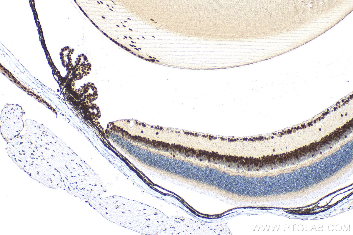 Immunohistochemistry (IHC) staining of mouse eye tissue using PAX6 Polyclonal antibody (12323-1-AP)