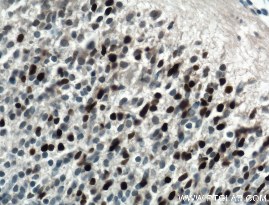 Immunohistochemistry (IHC) staining of mouse embryo tissue using PAX6 Polyclonal antibody (12323-1-AP)