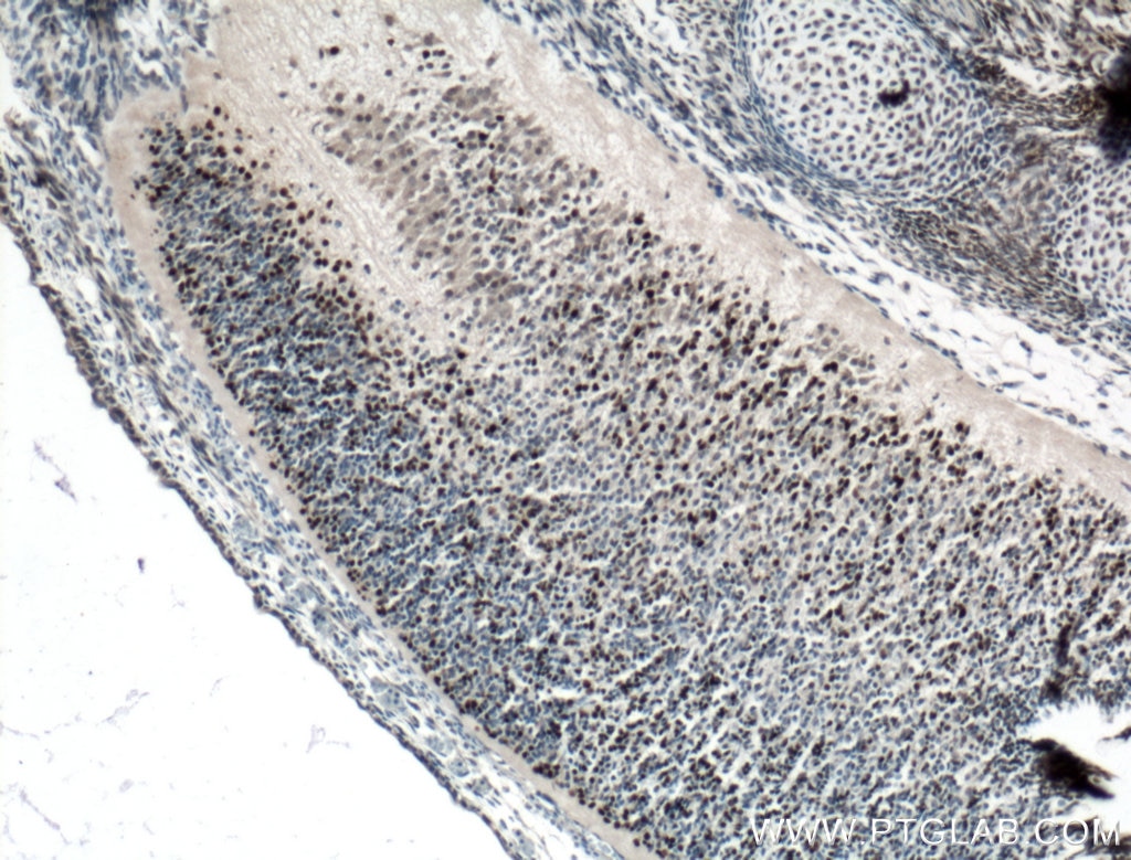 Immunohistochemistry (IHC) staining of mouse embryo tissue using PAX6 Polyclonal antibody (12323-1-AP)