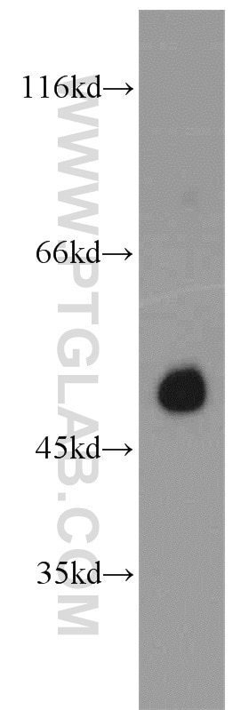 Western Blot (WB) analysis of human stomach tissue using PAX6 Polyclonal antibody (12323-1-AP)