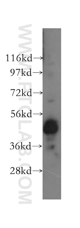 PAX6 Polyclonal antibody