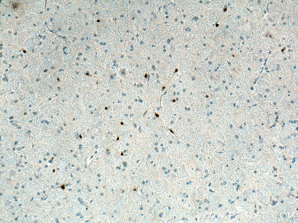 IHC staining of rat brain using 67529-1-Ig