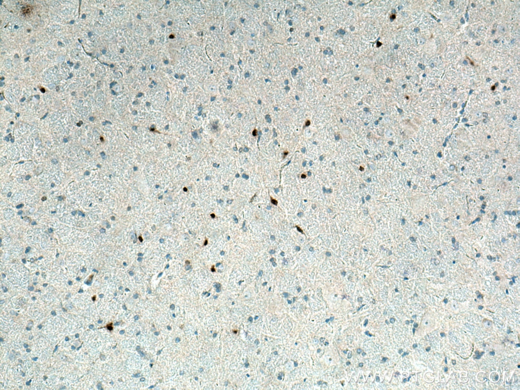 Immunohistochemistry (IHC) staining of rat brain tissue using PAX6 Monoclonal antibody (67529-1-Ig)