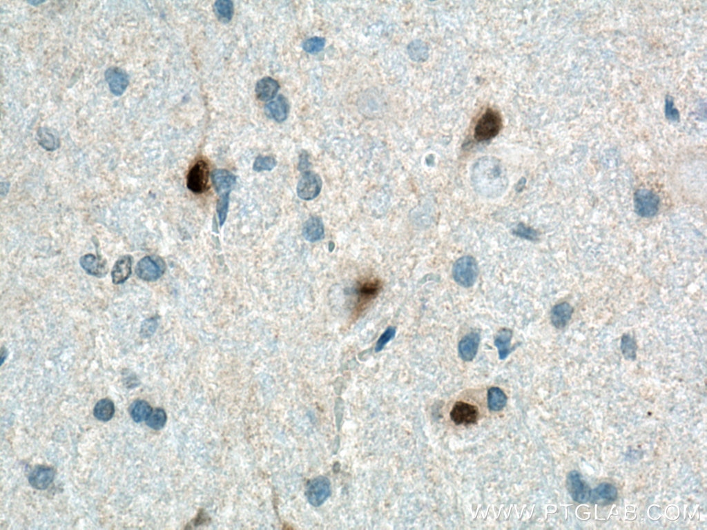 Immunohistochemistry (IHC) staining of rat brain tissue using PAX6 Monoclonal antibody (67529-1-Ig)