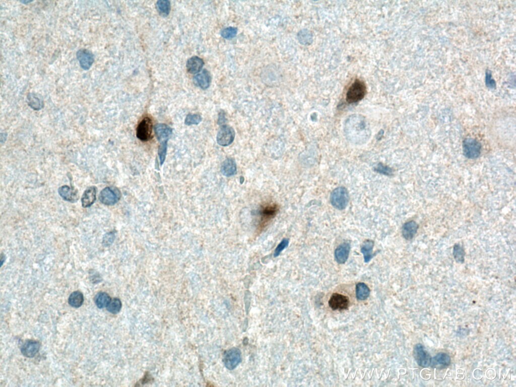 Immunohistochemistry (IHC) staining of rat brain tissue using PAX6 Monoclonal antibody (67529-1-Ig)