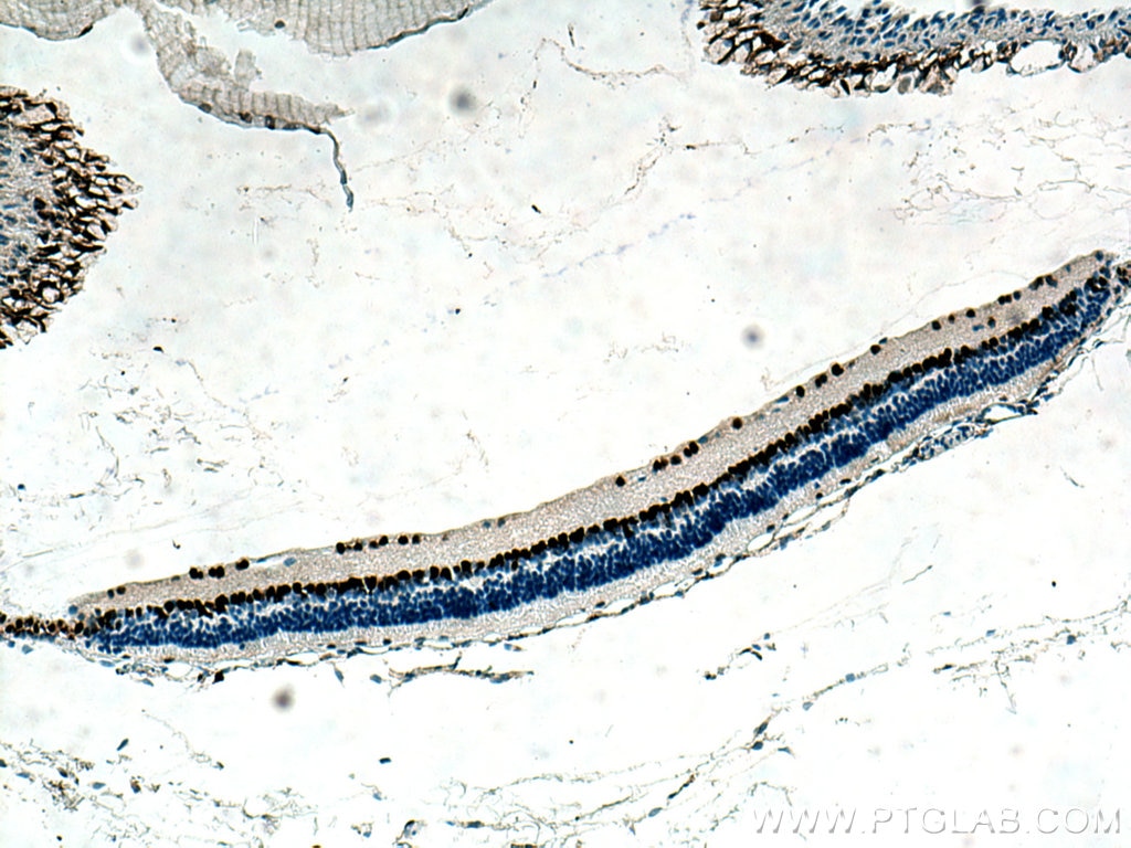 Immunohistochemistry (IHC) staining of mouse eye tissue using PAX6 Monoclonal antibody (67529-1-Ig)