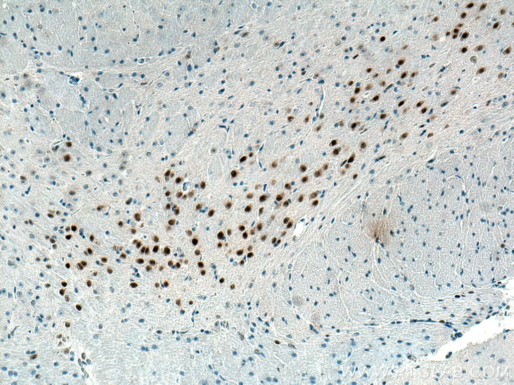 Immunohistochemistry (IHC) staining of mouse brain tissue using PAX6 Monoclonal antibody (67529-1-Ig)