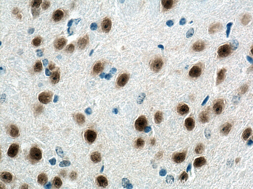 Immunohistochemistry (IHC) staining of mouse brain tissue using PAX6 Monoclonal antibody (67529-1-Ig)