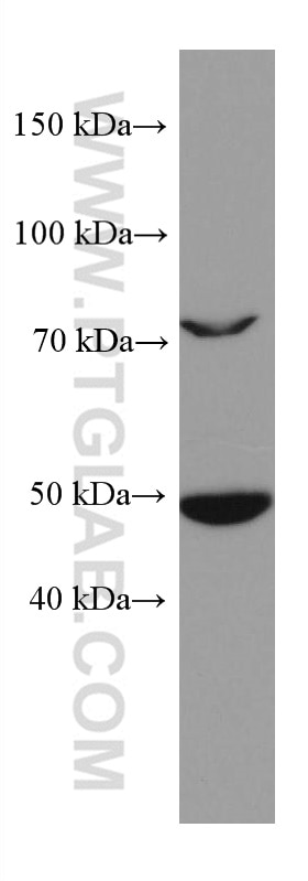Western Blot (WB) analysis of Neuro-2a cells using PAX6 Monoclonal antibody (67529-1-Ig)
