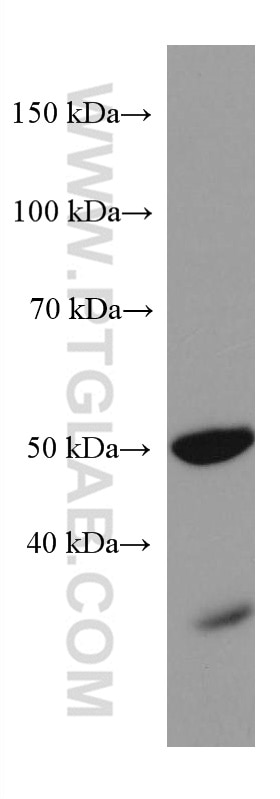 Western Blot (WB) analysis of rat retina tissue using PAX6 Monoclonal antibody (67529-1-Ig)