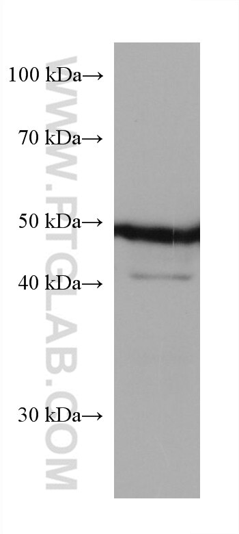 Western Blot (WB) analysis of JAR cells using PAX6 Monoclonal antibody (67529-1-Ig)