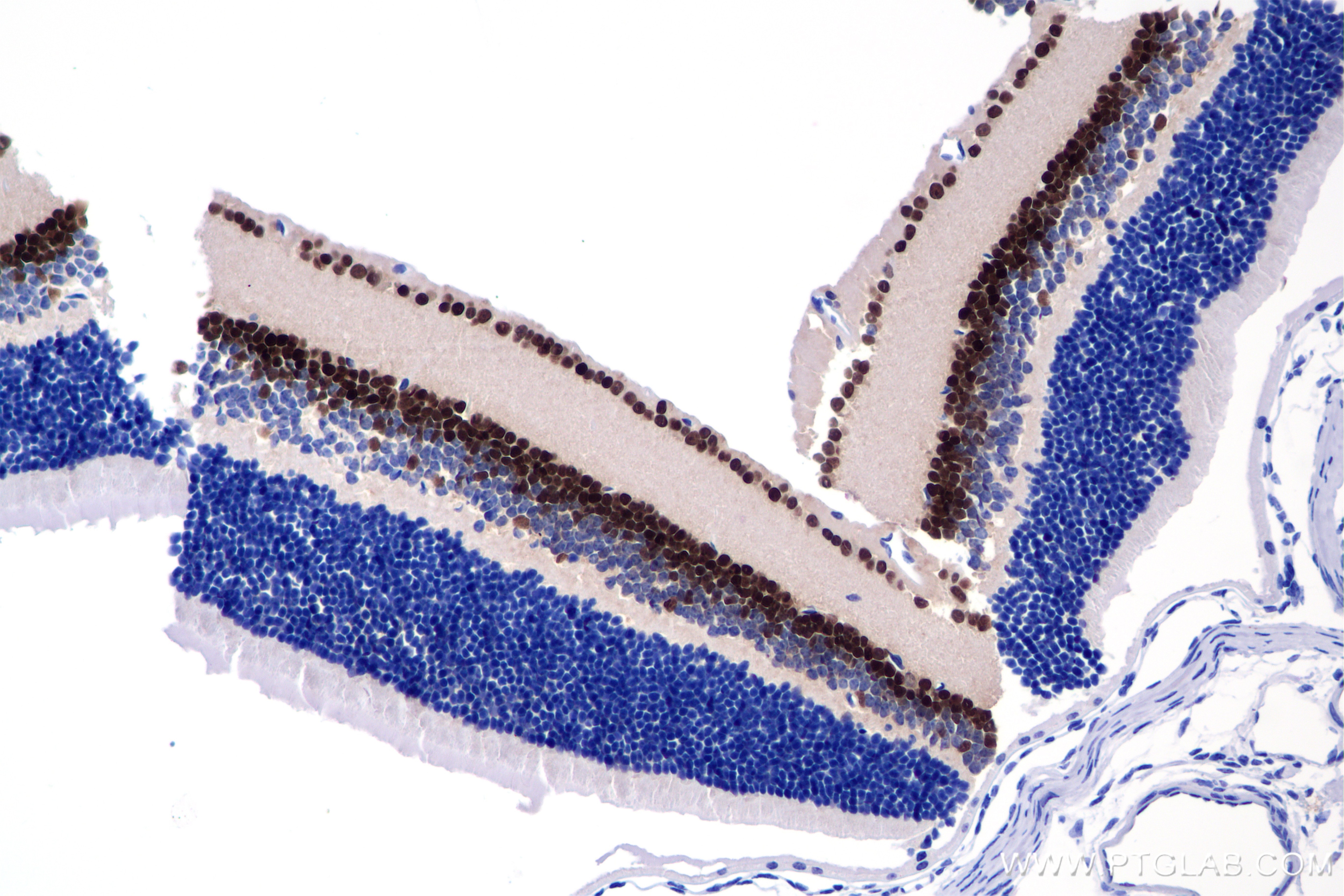 Immunohistochemistry (IHC) staining of mouse eye tissue using PAX6 Recombinant monoclonal antibody (84345-5-RR)