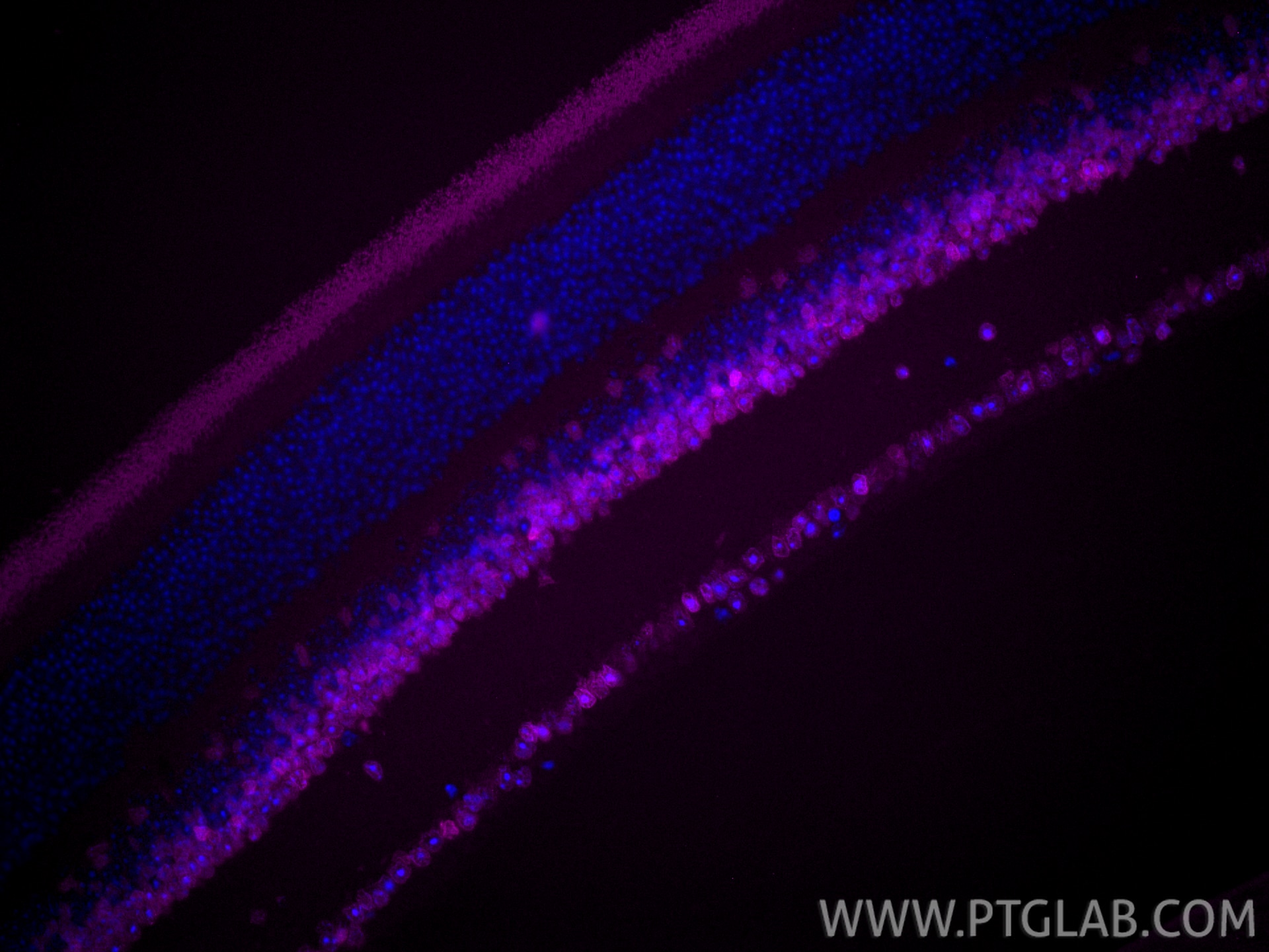 Immunofluorescence (IF) / fluorescent staining of mouse eye tissue using CoraLite® Plus 647-conjugated PAX6 Recombinant mon (CL647-84345-5)