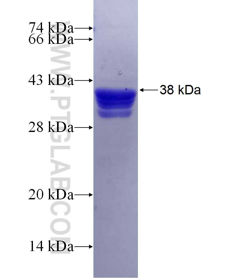 PAX6 fusion protein Ag29977 SDS-PAGE