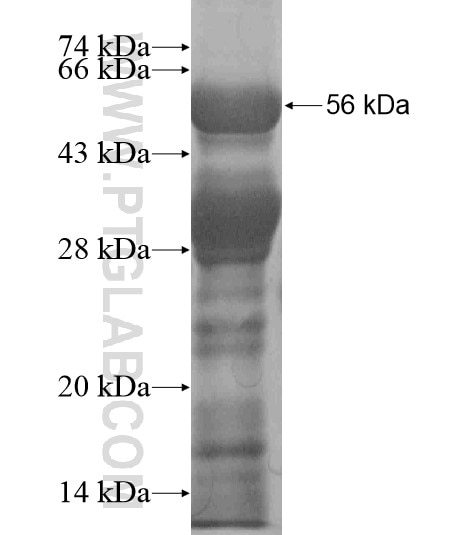 PAX6 fusion protein Ag19014 SDS-PAGE