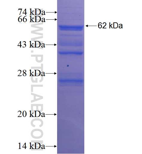 PAX6 fusion protein Ag2984 SDS-PAGE