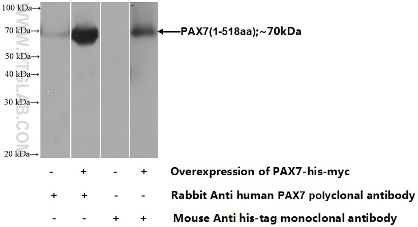 PAX7 Polyclonal antibody