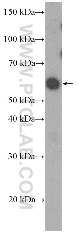 Western Blot (WB) analysis of NCCIT cells using PAX7 Polyclonal antibody (20570-1-AP)