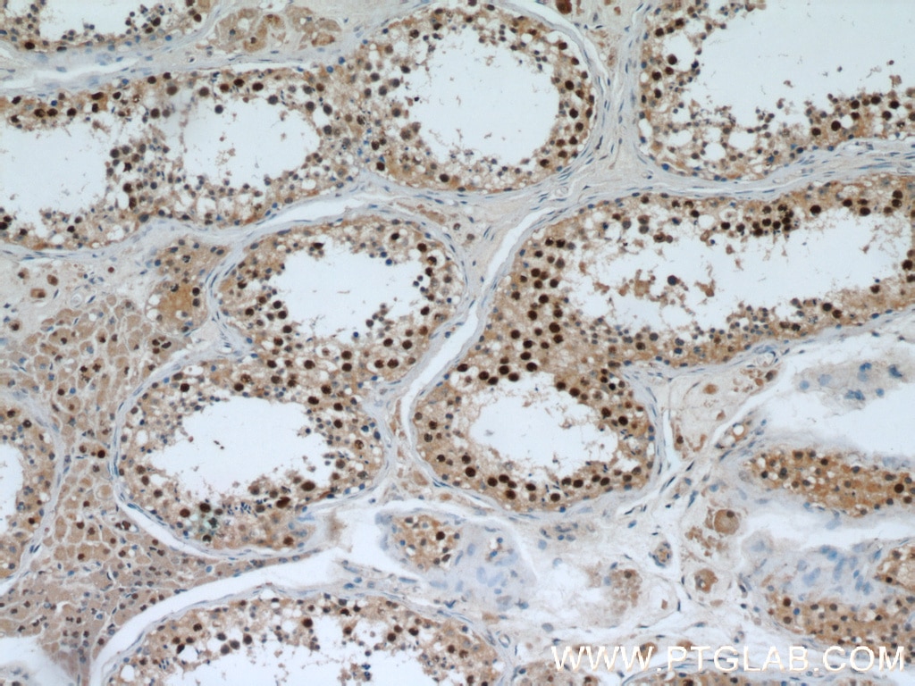 Immunohistochemistry (IHC) staining of human testis tissue using PAX7 Monoclonal antibody (60236-1-Ig)