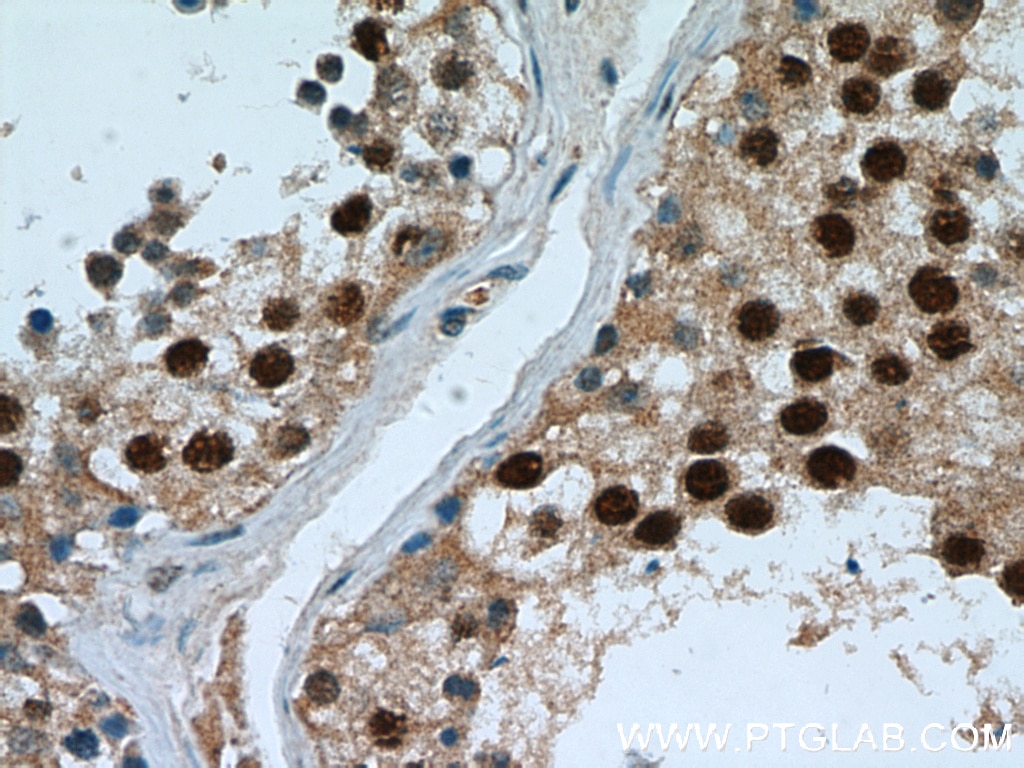 Immunohistochemistry (IHC) staining of human testis tissue using PAX7 Monoclonal antibody (60236-1-Ig)