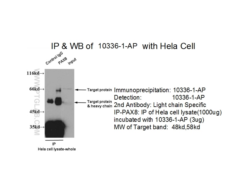 Immunoprecipitation (IP) experiment of HeLa cells using PAX8 Polyclonal antibody (10336-1-AP)
