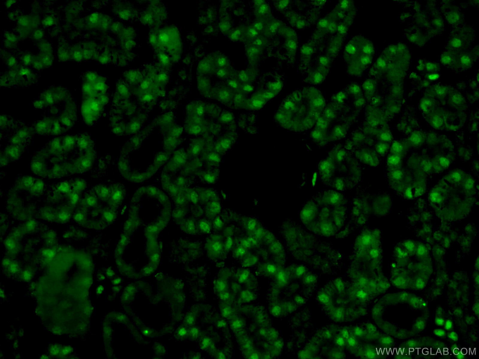Immunofluorescence (IF) / fluorescent staining of mouse kidney tissue using PAX8 Polyclonal antibody (10336-1-AP)
