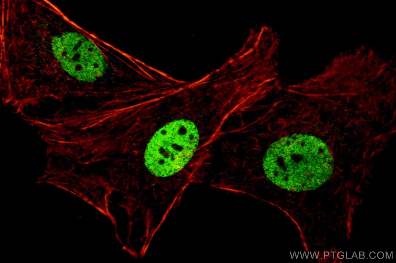Immunofluorescence (IF) / fluorescent staining of SKOV-3 cells using PAX8 Polyclonal antibody (10336-1-AP)