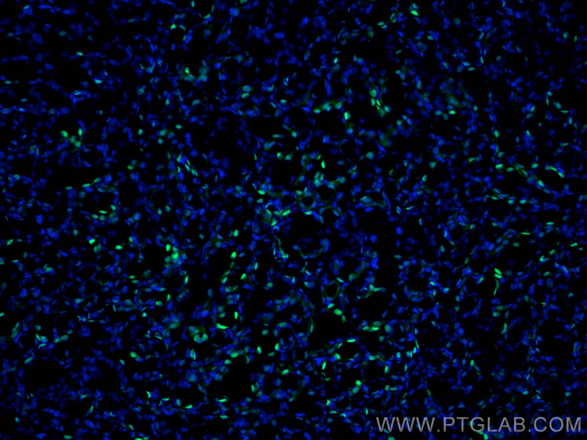 Immunofluorescence (IF) / fluorescent staining of mouse kidney tissue using PAX8 Polyclonal antibody (10336-1-AP)