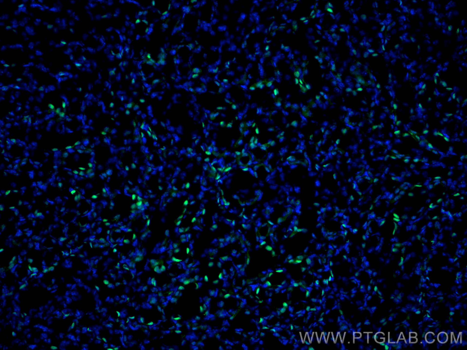 IF Staining of mouse kidney using 10336-1-AP