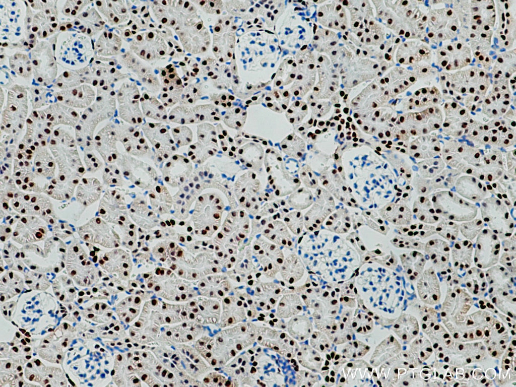 Immunohistochemistry (IHC) staining of mouse kidney tissue using PAX8 Polyclonal antibody (10336-1-AP)