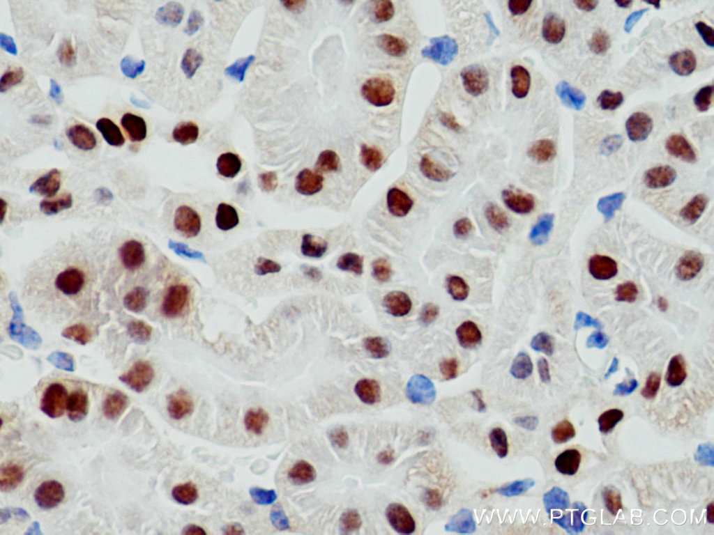 Immunohistochemistry (IHC) staining of mouse kidney tissue using PAX8 Polyclonal antibody (10336-1-AP)