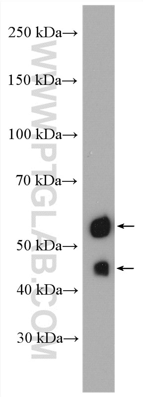 Western Blot (WB) analysis of SKOV-3 cells using PAX8 Polyclonal antibody (10336-1-AP)