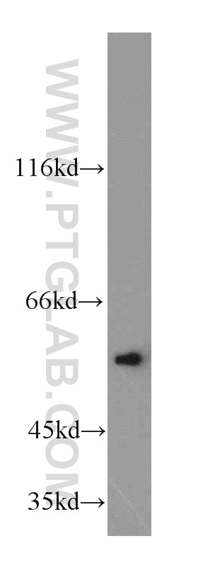 Western Blot (WB) analysis of HEK-293 cells using PAX8 Polyclonal antibody (10336-1-AP)