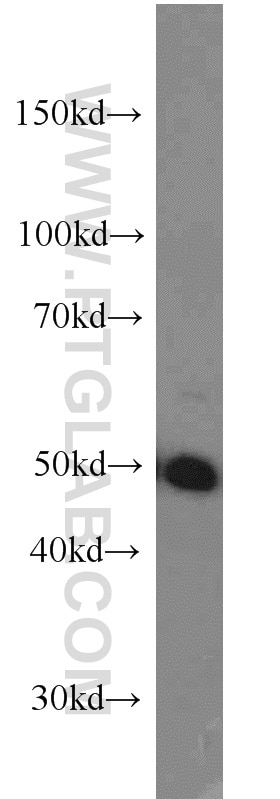 PAX8 Polyclonal antibody