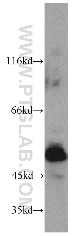 Western Blot (WB) analysis of Raji cells using PAX8 Polyclonal antibody (10336-1-AP)