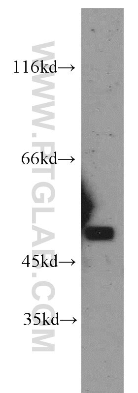 Western Blot (WB) analysis of mouse brain tissue using PAX8 Polyclonal antibody (21384-1-AP)