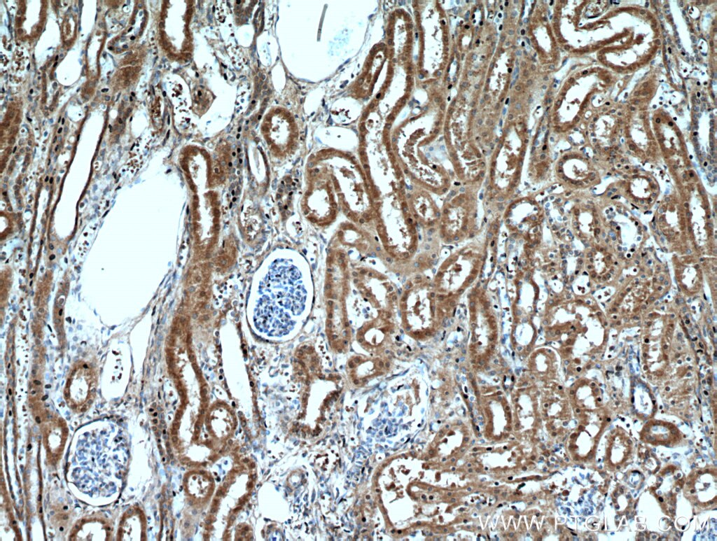 Immunohistochemistry (IHC) staining of human kidney tissue using PAX8 Polyclonal antibody (22255-1-AP)