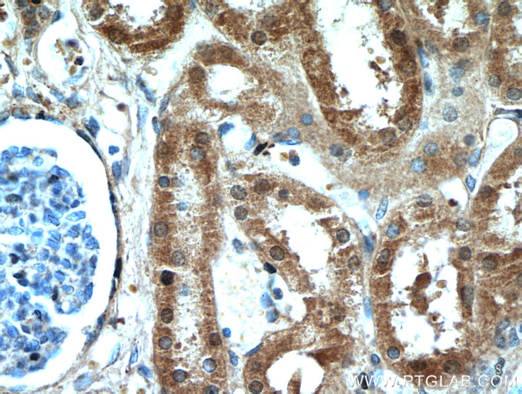 Immunohistochemistry (IHC) staining of human kidney tissue using PAX8 Polyclonal antibody (22255-1-AP)