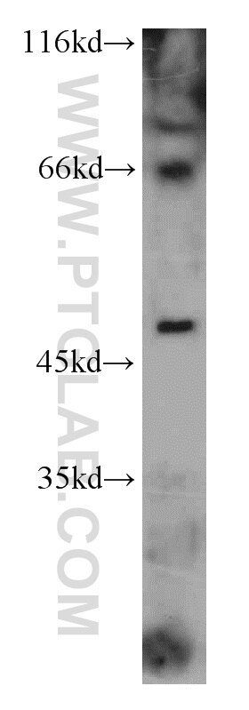 Western Blot (WB) analysis of A2780 cells using PAX8 Polyclonal antibody (22255-1-AP)