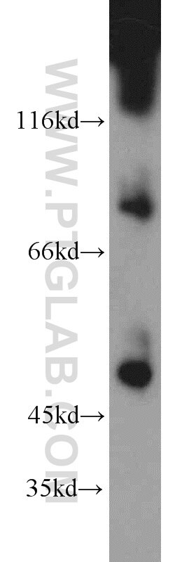 Western Blot (WB) analysis of A2780 cells using PAX8 Polyclonal antibody (22255-1-AP)