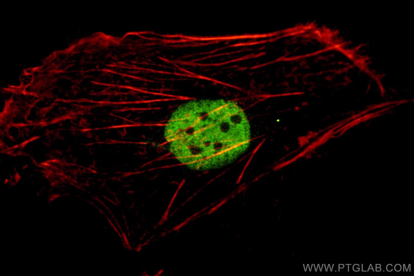 Immunofluorescence (IF) / fluorescent staining of SKOV-3 cells using PAX8 Monoclonal antibody (60145-4-Ig)