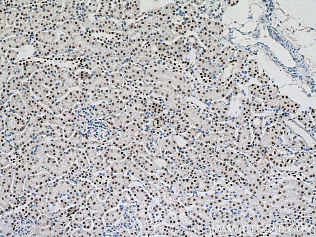 Immunohistochemistry (IHC) staining of mouse kidney tissue using PAX8 Monoclonal antibody (60145-4-Ig)