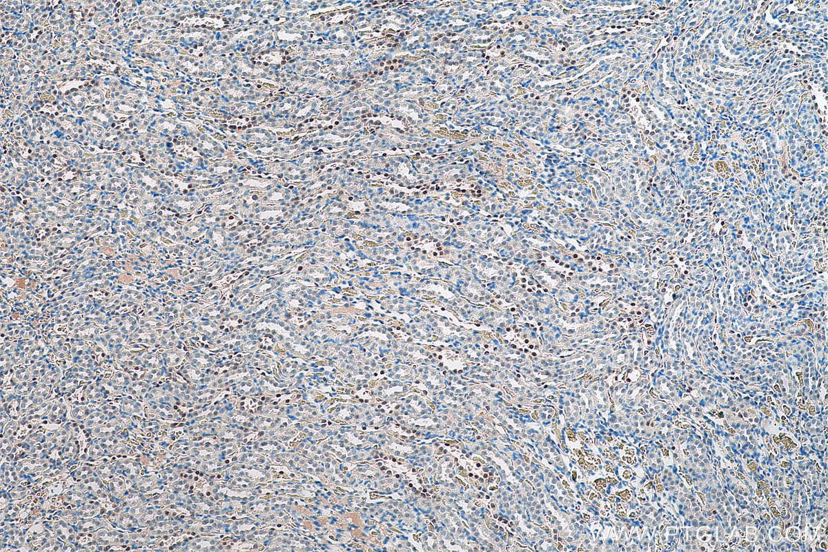 Immunohistochemistry (IHC) staining of rat kidney tissue using PAX8 Monoclonal antibody (60145-4-Ig)