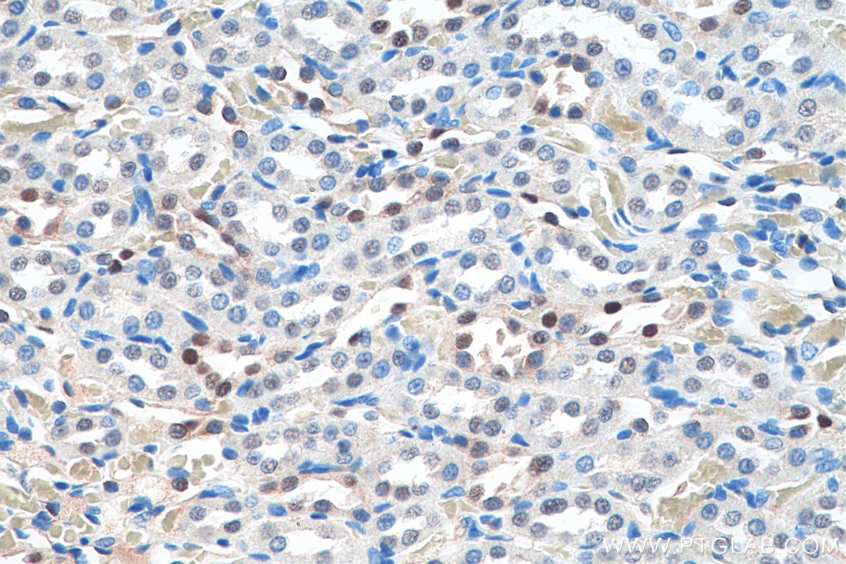 Immunohistochemistry (IHC) staining of rat kidney tissue using PAX8 Monoclonal antibody (60145-4-Ig)
