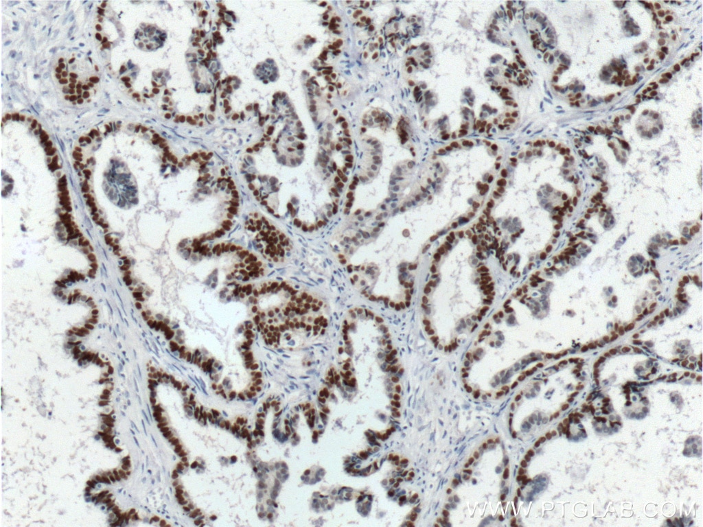 PAX8 Monoclonal antibody