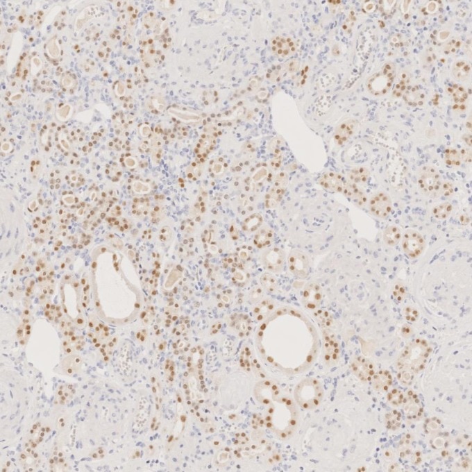 IHC staining of human kidney using 60145-4-Ig Immunohistochemistry (IHC) staining of human kidney tissue using PAX8 Monoclonal antibody (60145-4-Ig)