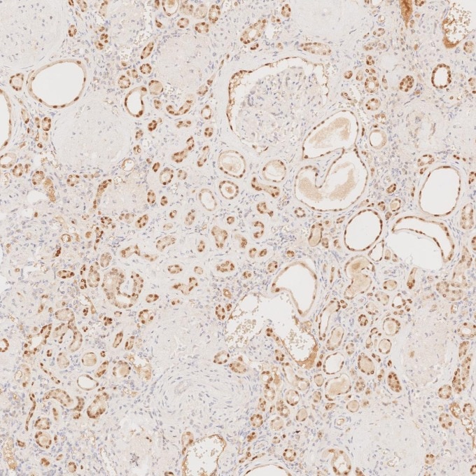 IHC staining of human kidney using 60145-4-Ig Immunohistochemistry (IHC) staining of human kidney tissue using PAX8 Monoclonal antibody (60145-4-Ig)