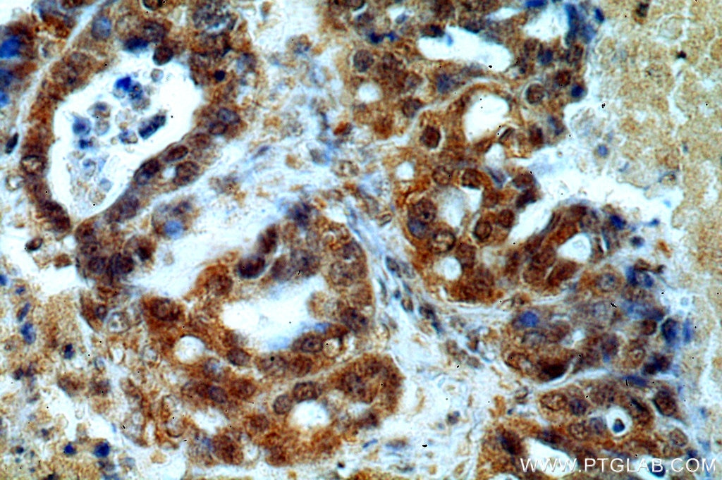 PAX8 Monoclonal antibody