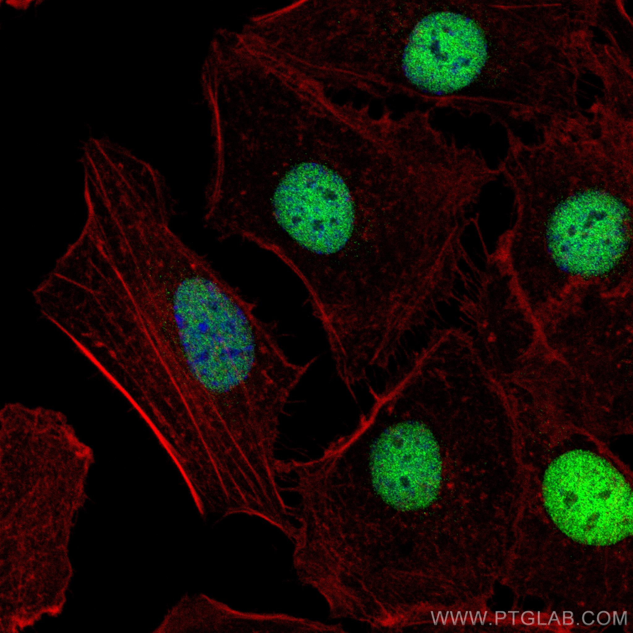 Immunofluorescence (IF) / fluorescent staining of SKOV-3 cells using PAX8 Recombinant antibody (80756-1-RR)