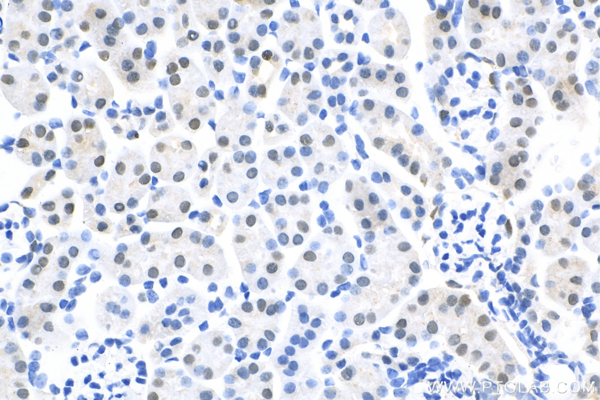 Immunohistochemistry (IHC) staining of mouse kidney tissue using PAX8 Recombinant antibody (80756-1-RR)